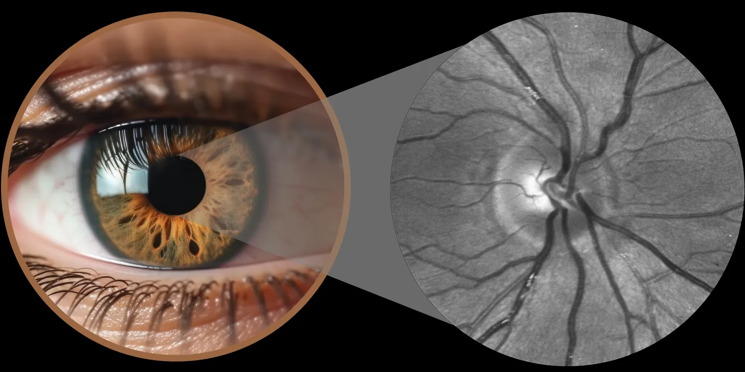 Eye+Pendant-scheme-vertical-retina
